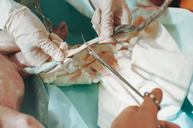 A,Doctor,Holds,A,New,Born,Baby,Whilst,Another,Doctor