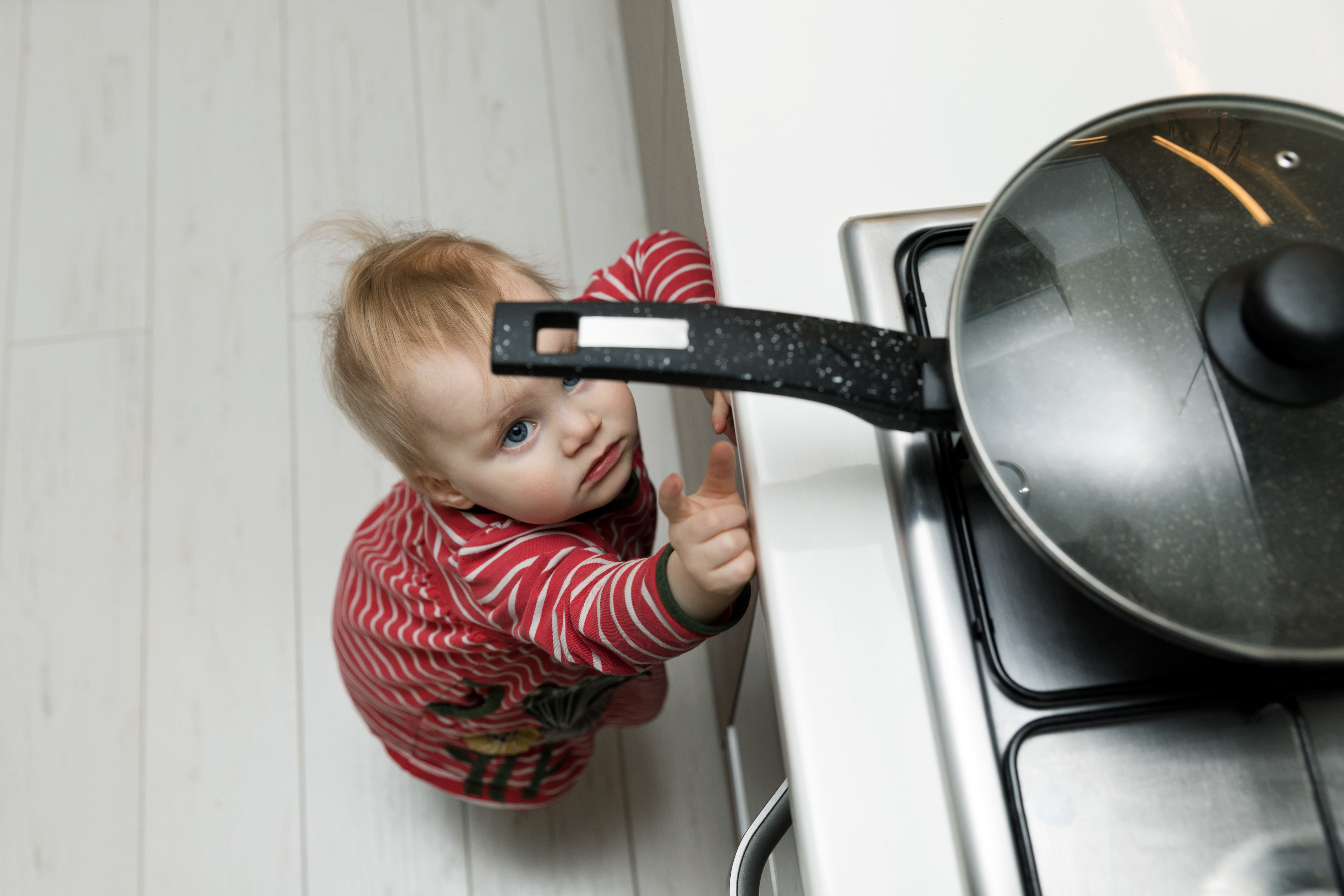 Meu bebê se queimou… e agora?
